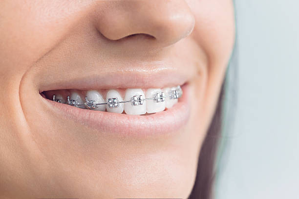 Best Dental Exams and Cleanings  in San Juan Pistrano, CA